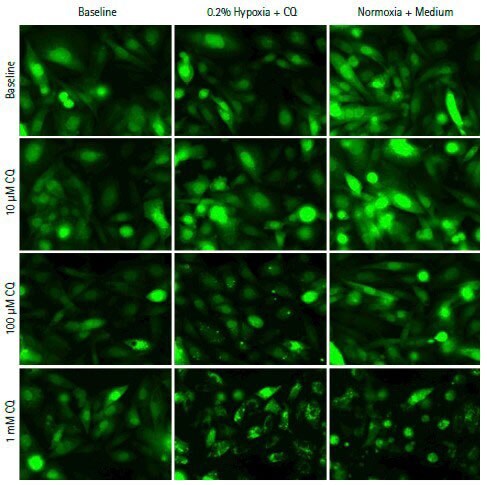 Cells cultured on the CellASIC™ ONIX microfluidic live cell imaging system CellASIC® 시스템을 이용한 저산소 유발성 자가포식 분석법에서의 생세포 이미징