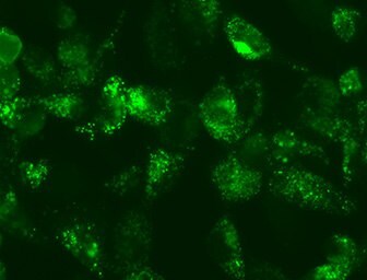 LentiBrite LC3 Lentiviral Particle autophagy assay 자가포식을 평가하는 형광 렌티바이러스 입자 세포 분석