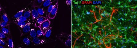 Live-cell imaging and analysis 생세포 이미징 및 분석