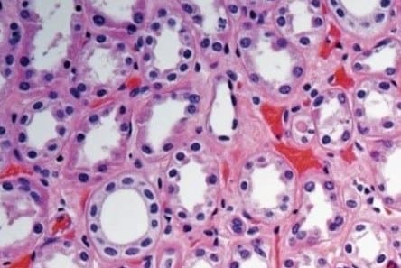 Histopathological examination of H&E stained paraffin-embedded renal tissue