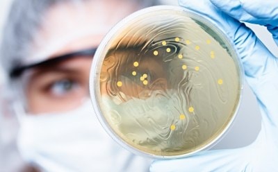 Scientist observing petri dish with bacterial colonies