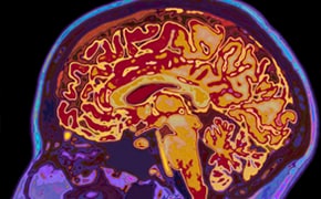 A detailed MRI scan of a human brain, showcasing a cross-section with various regions highlighted in bright colors such as yellow, red, and orange, set against a contrasting blue and purple background, emphasizing the complex structure and organization of the brain.