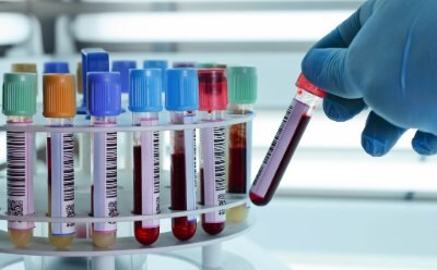 A gloved hand places a test tube holding a blood sample into a plastic laboratory test tube rack holding other blood samples with various colored lids A gloved hand places a test tube holding a blood sample into a plastic laboratory test tube rack holding other blood samples with various colored lids