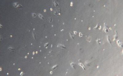 Kupffer C Microscopy image of Kupffer cells at 48 hours. Light grey square with small dark grey dots and small rectangles that indicate cells.