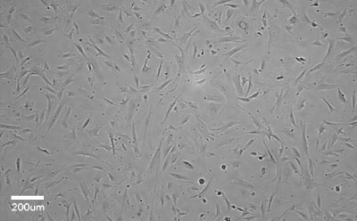 Stellate Cells Phase contrast microscopy image of stellate cells. Light grey square with dark grey dots and elongated dark grey rectangles representing the cells.