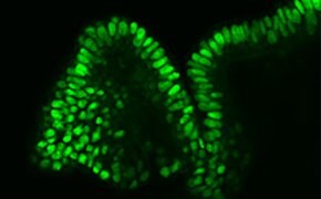 3D Cell Culture