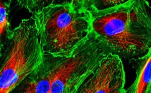 Primary cells in culture