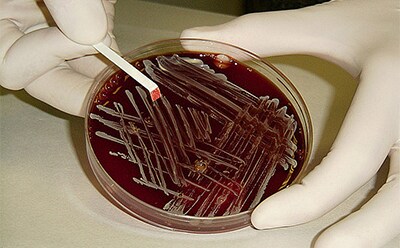 Biochemical tests integrated on strips, discs, and membranes for easy use