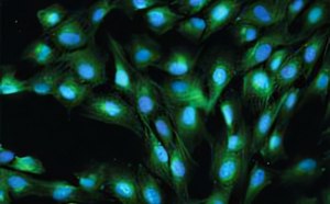 Equine exuberant granulation (proud flesh) tissue stained using Anti-von Wille
