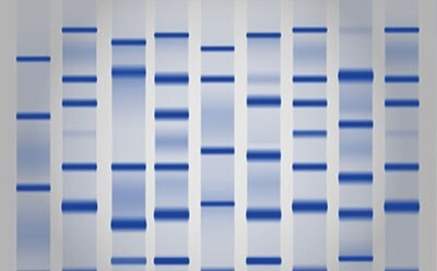An image of a gel stain, showing protein bands. There are nine vertical columns that all have at least three horizontal bands representing the proteins. An image of a gel stain, showing protein bands. There are nine vertical columns that all have at least three horizontal bands representing the proteins.