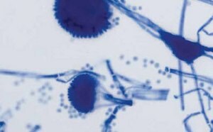 Bacteriology Stains
