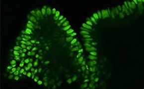 Fluorescent staining of Human iPS cell-derived Colon Organoids, SCC300