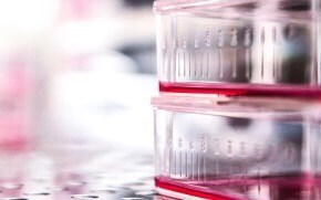 Raw material testing for biopharmaceutical manufacturing We offer a wide range of test services to ensure raw material quality and purity in cell banks, seed viruses, and finished products