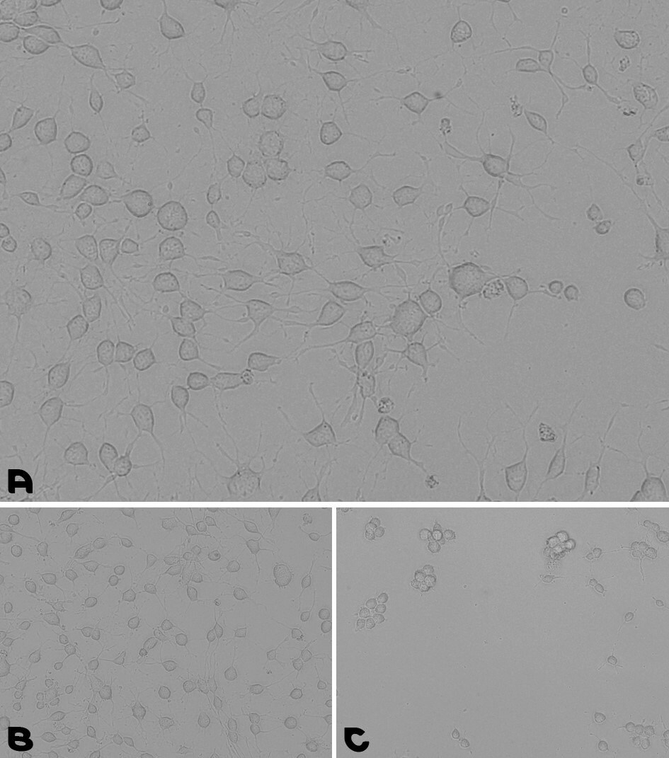 Neural stem cells culturing assay. A. Coating prepared by a 1-hour incubation at 37°C with the pre-mixed coating Solution of Laminin with PDL. B. Coating prepared by an overnight incubation with PDL, followed by a wash and a second overnight incubation with Laminin. C. NSCs were cultured for 48 hours on a TC plate without any coating. Microscopy images of cell adhesion during a neural stem cells culturing assay