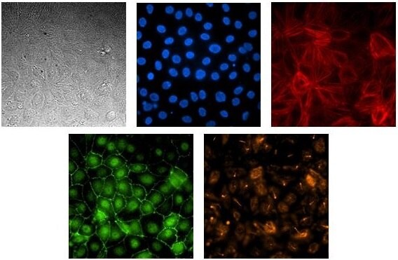 Renal proximal tubule epithelial cell line SA7K form a polarized, tight barrier on the AIM Biotech chip.