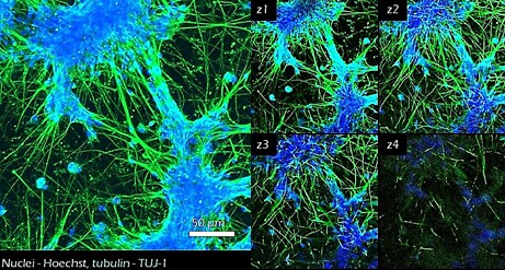 Application of TrueGel® HTS hydrogels in culturing iPSC-derived neural stem cells