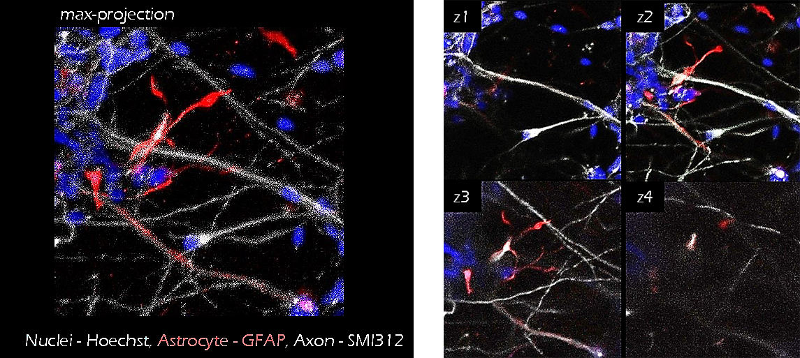 Application of TrueGel® HTS hydrogels in iPS neuron/astrocyte co-cultures