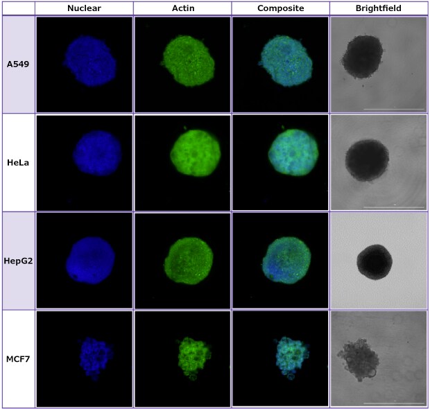 Spheroids Formed in Millicell® Ultra-Low Attachment Plates Spheroids formed in Millicell® Ultra-low attachment plates were imaged using brightfield and confocal imaging.