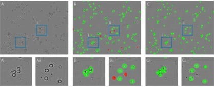 Improvement of the artificial intelligence algorithm of the Corning Cell Counter. A) unprocessed image. B) Results of the old algorithm, many cells in clusters are not detected properly and debris is wrongly detected as dead cells. C) Results of the new algorithm, all individual cells within clusters are detected properly and no debris is detected as dead cells. Ai-Cii) Zoomed in images of blue boxes containing examples of the improved individual cell detection (i) and dead cell detection (ii).