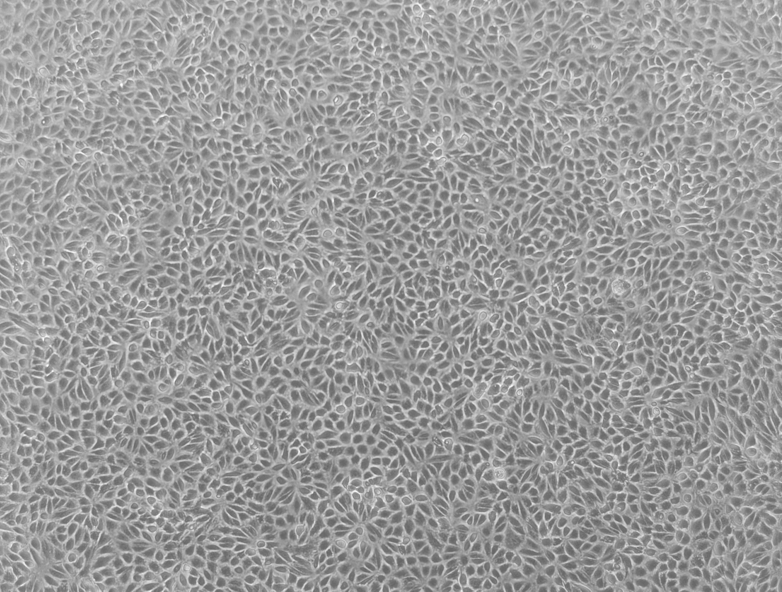 Human renal proximal tubule epithelial cells (RPTECs) are commonly used to predict human renal drug permeability and to investigate drug efflux. We have generated transporter knockout (KO) cell lines using CompoZr® Zinc Finger Nuclease (ZFN) technology in a proprietary renal proximal tubule epithelial cell line.