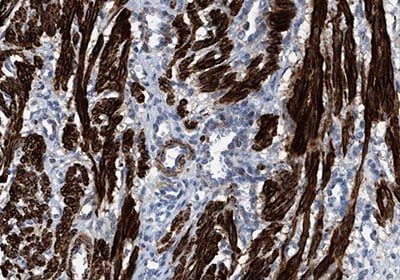 Immunohistochemical staining of smooth muscle cell (SMC)