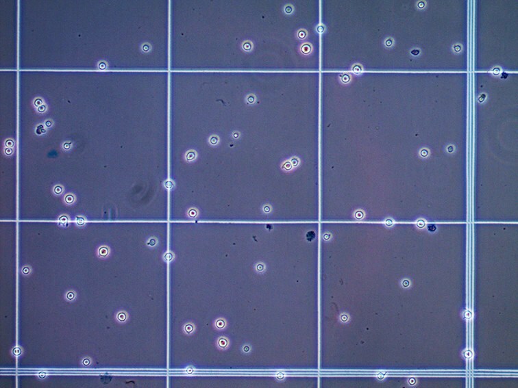 Trypan Blue Cell Counting