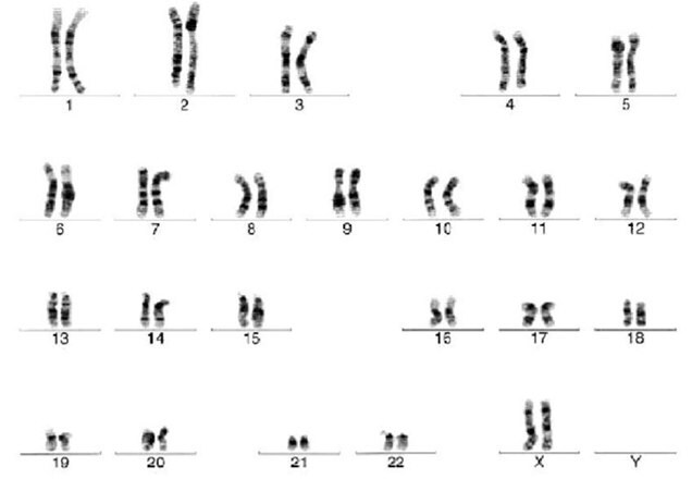 Cytogenetic analysis reveals a normal karyotype for H7 human embryonic stem cells.