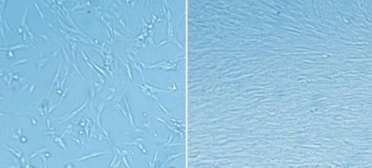 ECM matrix coating enables rapid expansion of fetal lung fibroblasts