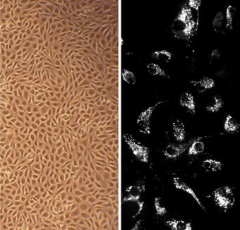 Bovine Aortic Endothelial Cells (BAOEC)