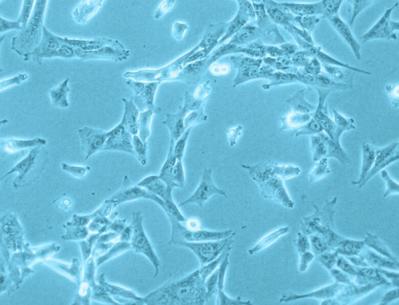Characterization of human placenta derived vascular pericytes Characterization of human placenta derived vascular pericytes