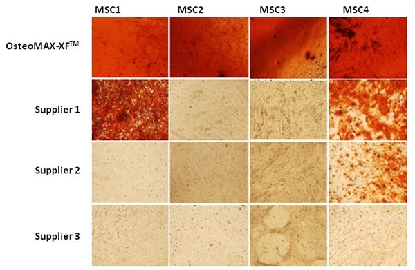 Validation and refinement of serum-free differentiation protocols