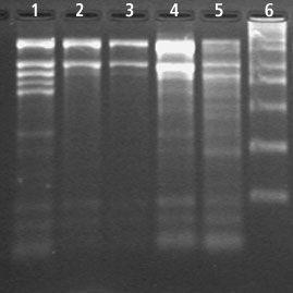 Total RNA Extraction from Cotton using Spectrum™ Total RNA Kit