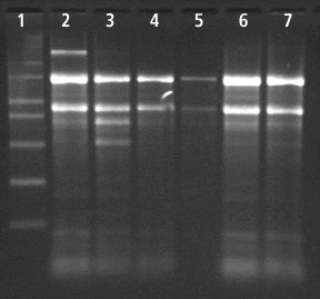 Total RNA Extraction from Sugarcane Leaf using Spectrum™ Total RNA kit