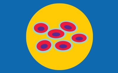 CHOOSE A CELL LINE FOR YOUR SCREEN スクリーニング対象の細胞株の選択
