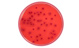 Escherichia Coli