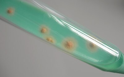 Mycobacteria Colonies On TB-Medium Mycobacteria colonies on TB-Medium