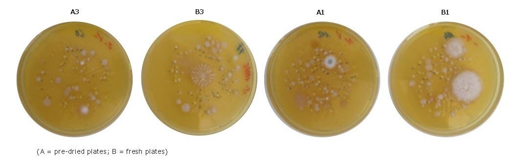 colonies-icr-settle-plates
