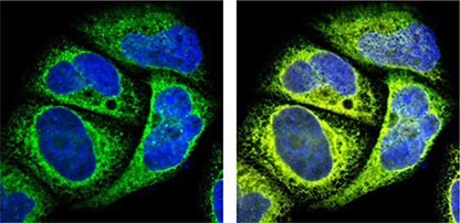 Organelle Markers in Subcellular Localization Studies