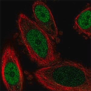 Immunofluorescent staining showing nuclear localization of the transcription factor, GBX2 (green) in human prostate cancer (PC-3) cells using Prestige Antibodies® Anti-GBX2 antibody that was produced in rabbit. Immunofluorescent staining showing nuclear localization of transcription factor