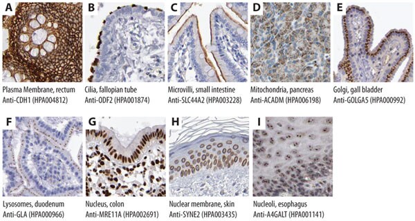 Immunohistochemical stainings showing subcellular localization using Prestige Antibodies®. Recognition of target antigen is represented by brown color. Immunohistochemical Stainings Showing Subcellular Localization