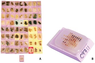 Cylinders from donor blocks are extracted and inserted into a recipient block. <b>A</b> Donor blocks of formalin fixed, paraffin embedded human tissues. <b>B</b> Recipient block (Tissue Microarray) representing 48 different human normal tissue types ready to be sectioned and used for IHC analysis. Tissue Microarray