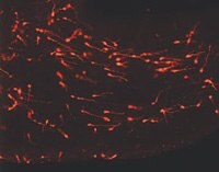 PKH26-Labeled Young Migrating Neurons