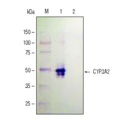 Extract preparation and Western Analysis