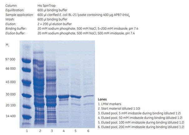 His SpinTrap SDS-PAGE