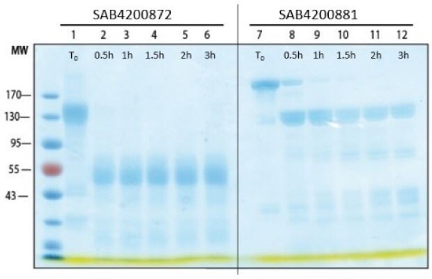 SDS-PAGE and western blot time course analysis of antibodies digested with pepsin Time course analysis of pepsin digested antibodies.