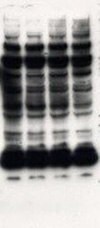 Wysokie tło, prowadzące do niespecyficznych pasm na Western blot