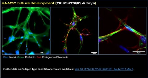 Microscopy images of human adipose MSCs cultured in 3D using TrueGel3D HTS hydrogel plates. Keywords: MSC, mesenchymal stem cells, truegel3d