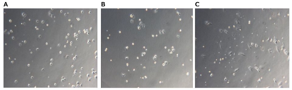 Example microscopy images of Kupffer cell culture after a.) 6 hours, b.) 24 hours, and c.) 48 hours. Microscopy image of Kupffer cells at 6, 24, and 48 hours. Light grey square with small dark grey dots that indicate cells.