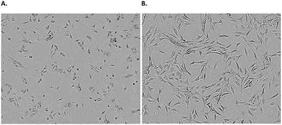 Adherent cell line