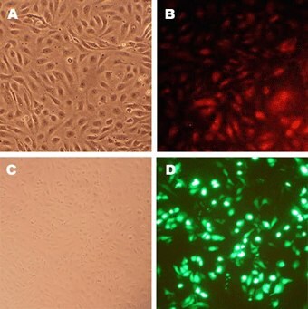 Human Coronary Artery Endothelial Cells (HCAEC) Human Coronary Artery Endothelial Cells (HCAEC)